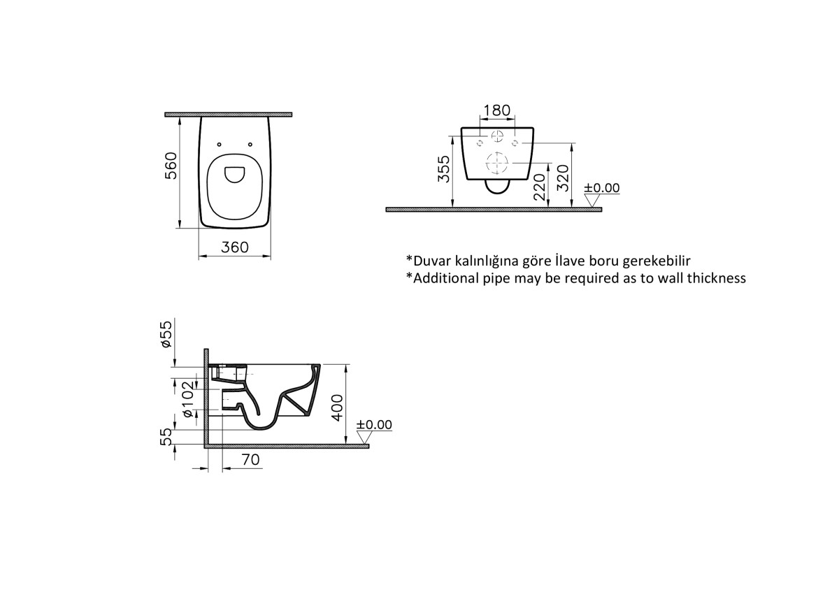 Инсталляция с унитазом VitrA Metropole 9820B003-7201 комплект 4 в 1 с сиденьем микролифт безободковый цвет клавиши матовый хром